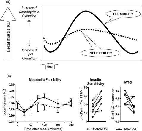 Figure-1-Metabolic-flexibility-and-metabolic-inflexibility-model-for-postabsorptive-and